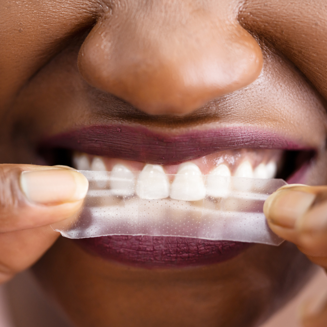 Two's Company PAP-X™ Advanced Teeth Whitening Strips Bundle-4